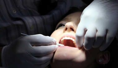 Die schleichende Gefahr: Parodontitis, die Entzündung des Zahnbetts